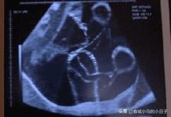 宣布懷孕的創(chuàng)意句子
