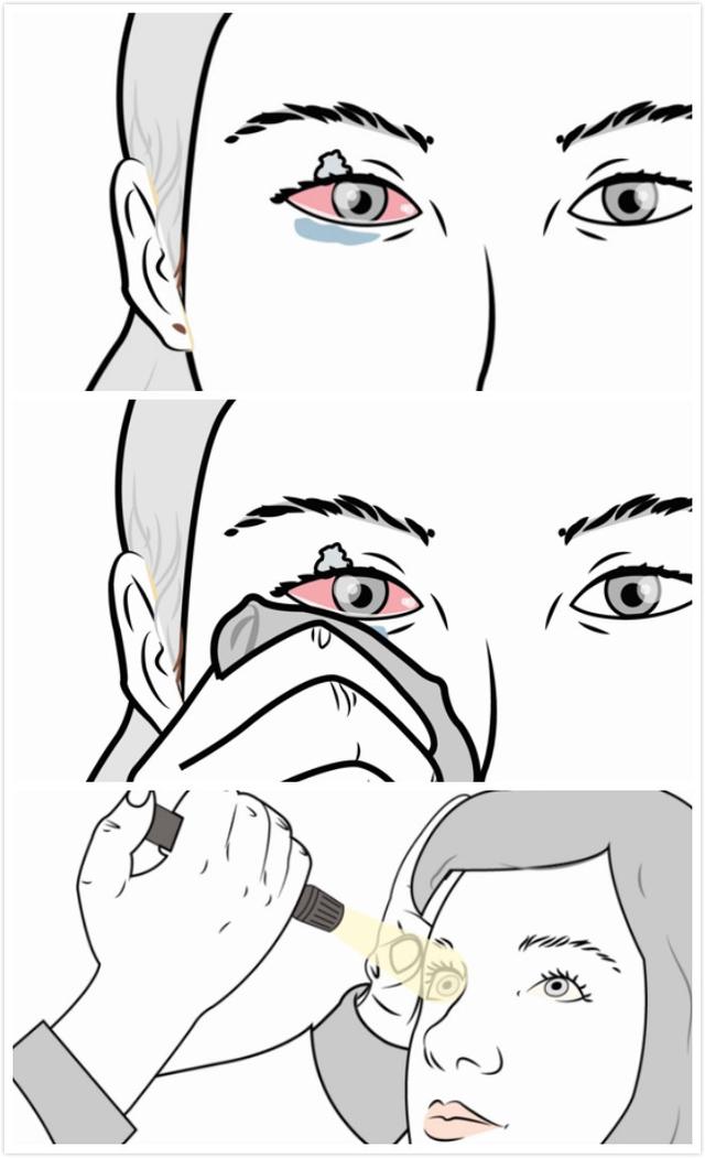 強力膠怎么去除