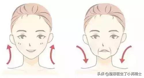 法令紋怎么形成的
