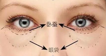臥蠶是什么