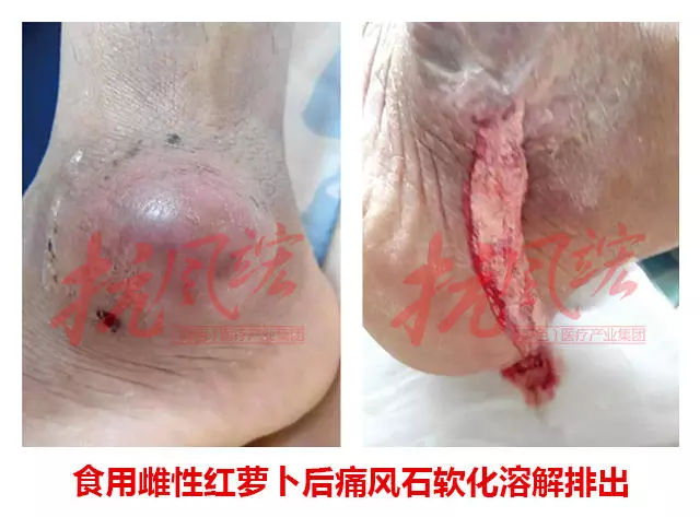 東北雌性紅蘿卜的功效