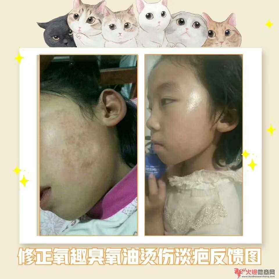 2019比較新微商加盟排行榜！健康體表殺產品免費加盟啦