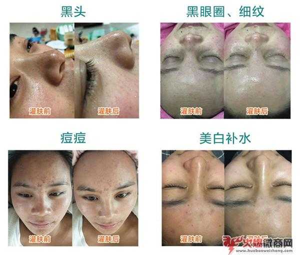 流暢度灌膚火爆微商界，微商新產(chǎn)品流暢度De.Mary怎么樣